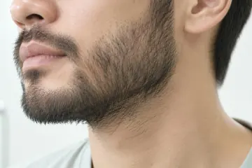 男性腮鬍與臉頰鬍渣特寫